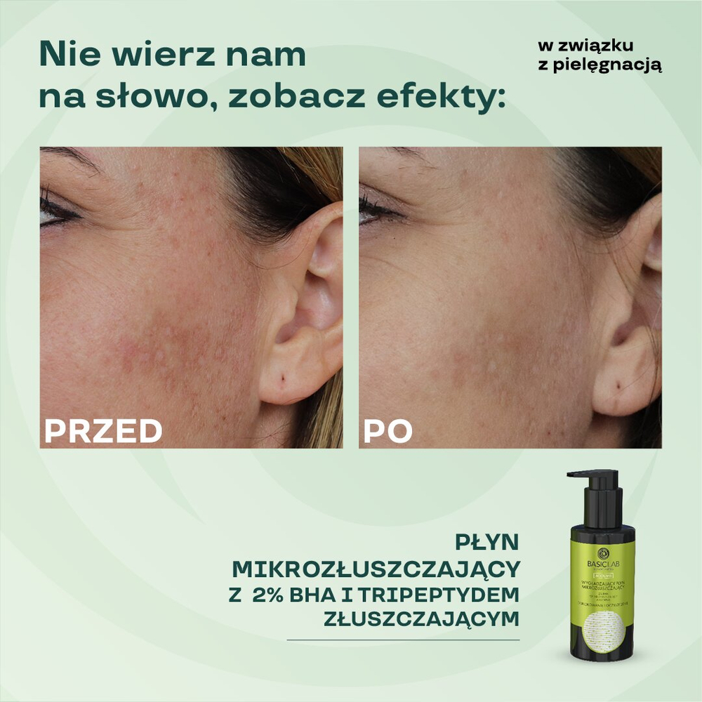 BasicLab Zaawansowany Płyn Mikrozłuszczający z 2%BHA dla Skóry Trądzikowej - 100 ml
