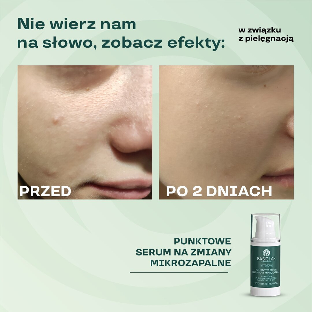 BasicLab Dermocosmetics Serum Punktowe na Zmiany Mikrozapalne dla Skóry Problematycznej 15ml