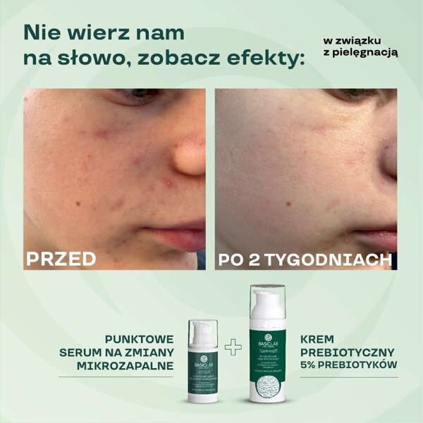 BasicLab Prebiotyczny Lekki Krem Wyciszający z 5% Prebiotyków 1% Wąkrotki Azjactyckiej i Witamina F Wzmocnienie i Balans dla Skóry Problematycznej na Dzień i na Noc 50ml